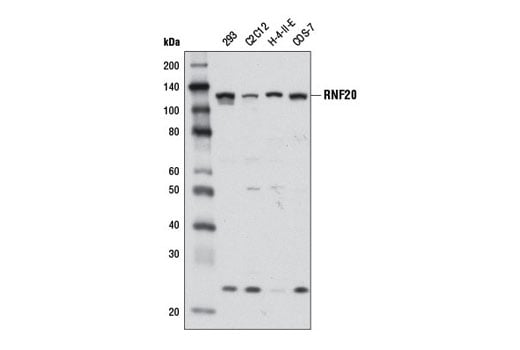 Western Blotting Image 1: RNF20 (D8C2) Rabbit mAb