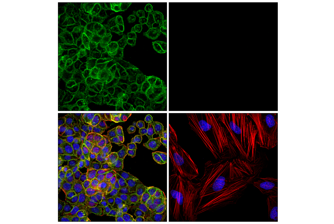 Immunofluorescence Image 1: EpCAM (VU1D9) Mouse Monoclonal Antibody