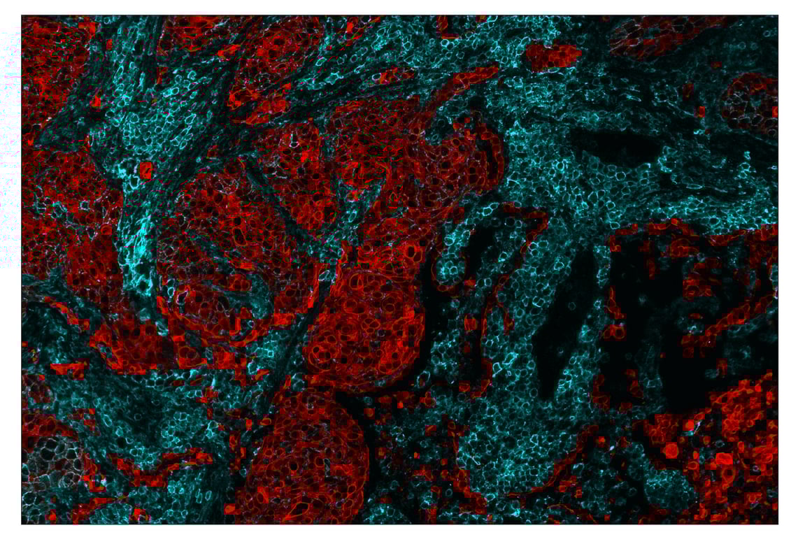 Immunohistochemistry Image 1: CD44 (E7K2Y) & CO-0030-594 SignalStar<sup>™</sup> Oligo-Antibody Pair