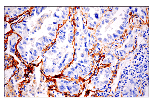 Immunohistochemistry Image 1: CD10/Neprilysin (E5P7S) Rabbit Monoclonal Antibody (BSA and Azide Free)