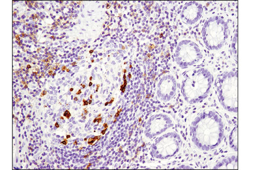 Immunohistochemistry Image 1: PD-1 (Intracellular Domain) (D4W2J) Rabbit Monoclonal Antibody
