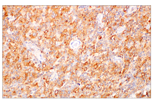 Immunohistochemistry Image 1: c-Rel (E8Z5Y) Rabbit Monoclonal Antibody (BSA and Azide Free)