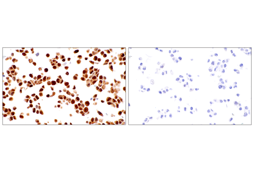 Immunohistochemistry Image 6: CDK2 (E8J9T) Rabbit Monoclonal Antibody (BSA and Azide Free)