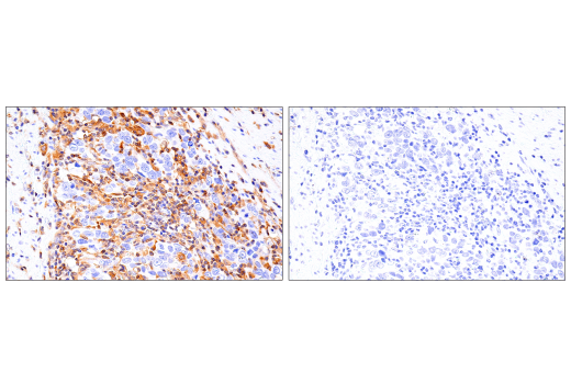 Immunohistochemistry Image 5: RIP3 (E7A7F) Rabbit Monoclonal Antibody