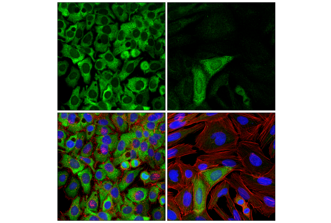 Immunofluorescence Image 1: NQO1 (D6H3A) Rabbit Monoclonal Antibody