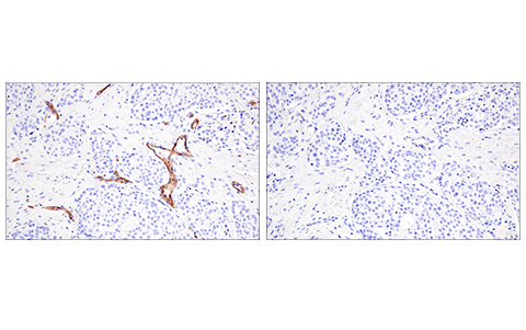 Immunohistochemistry Image 4: CD200 (E5I9V) Rabbit Monoclonal Antibody