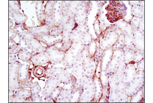Immunohistochemistry Image 3: Annexin A2 (D11G2) Rabbit Monoclonal Antibody (BSA and Azide Free)