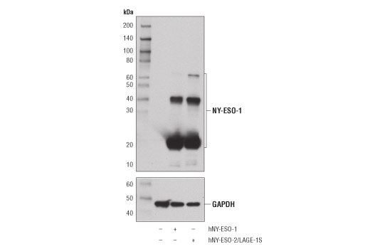 Western Blotting Image 2: NY-ESO-1 (D1Q2U) Rabbit Monoclonal Antibody
