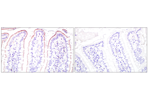 Immunohistochemistry Image 4: MUC13 (E6Z1K) Rabbit Monoclonal Antibody