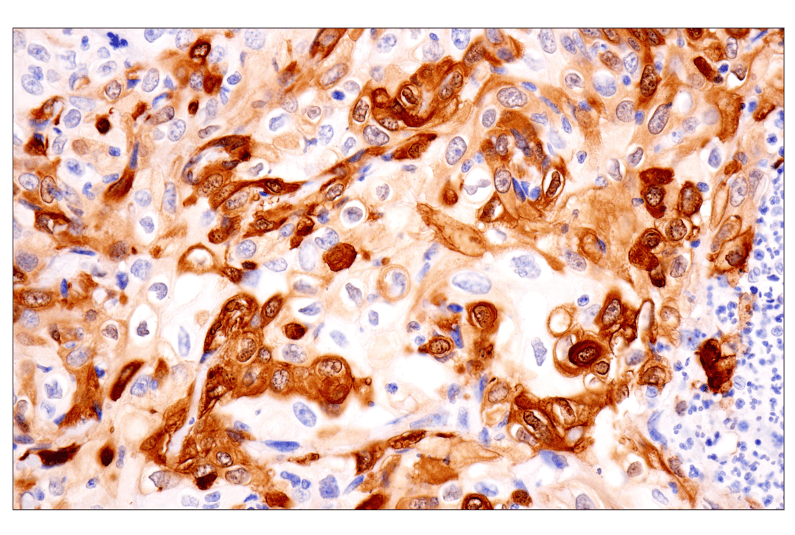 Immunohistochemistry Image 3: Transgelin/TAGLN (F3B7H) Rabbit Monoclonal Antibody