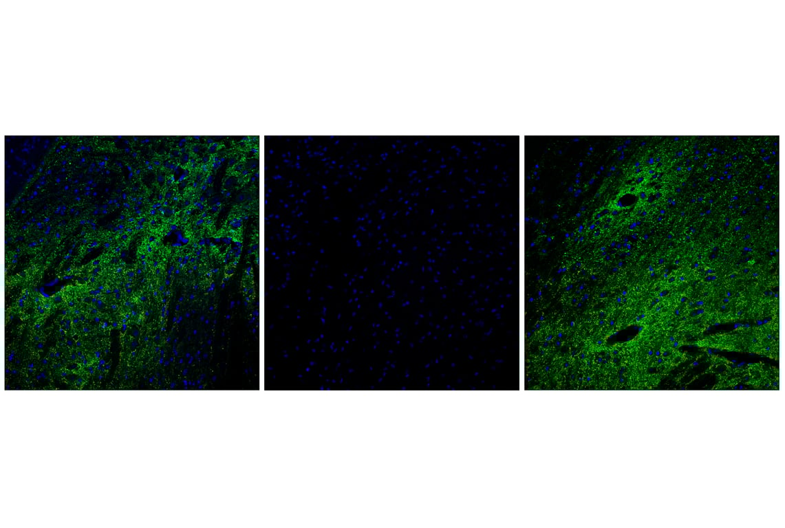 Immunofluorescence Image 1: Phospho-Synapsin-1 (Ser9) (E3D2X) Rabbit Monoclonal Antibody