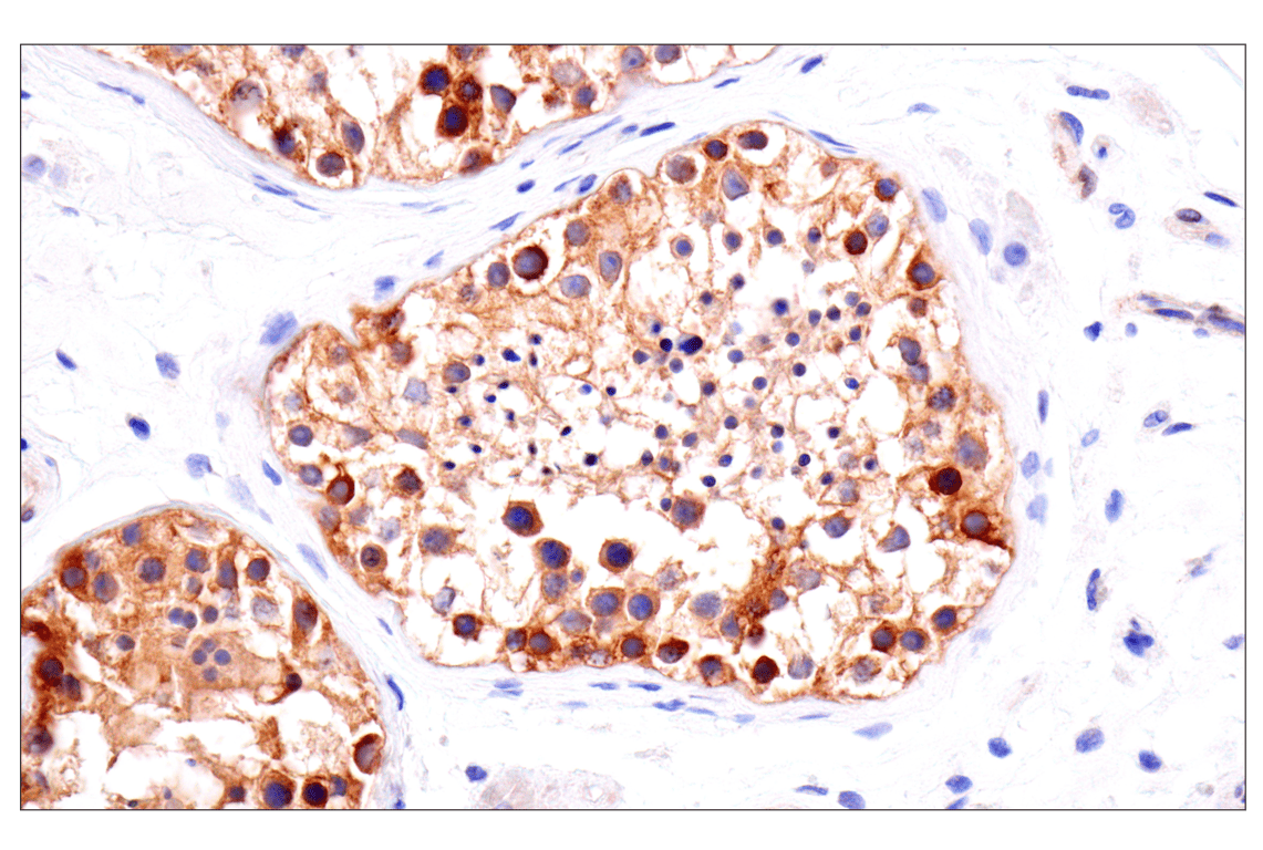 Immunohistochemistry Image 6: FAK (F7Z4C) Mouse Monoclonal Antibody (BSA and Azide Free)
