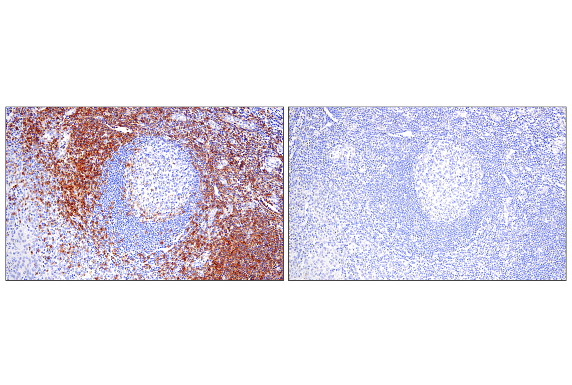 Immunohistochemistry Image 7: CD28 (D2Z4E) Rabbit Monoclonal Antibody (BSA and Azide Free)