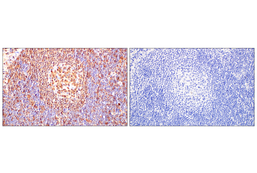 Immunohistochemistry Image 9: c-Rel (E8Z5Y) Rabbit Monoclonal Antibody