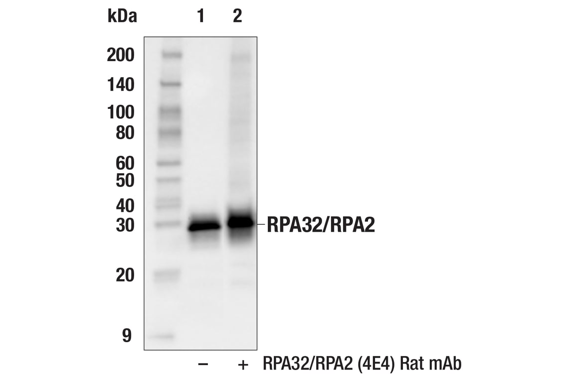 undefined Image 30: UV Induced DNA Damage Response Antibody Sampler Kit