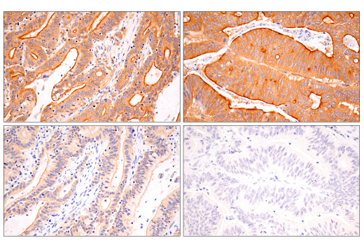 Immunohistochemistry Image 6: B-Raf (E3T5C) Mouse Monoclonal Antibody (BSA and Azide Free)
