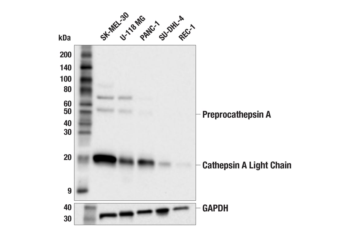 Western Blotting Image 3: Cathepsin A (F8X9E) Rabbit Monoclonal Antibody