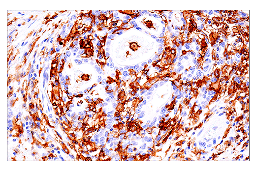 Immunohistochemistry Image 4: LAIR-1 (E7X6I) Rabbit Monoclonal Antibody