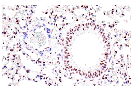 Immunohistochemistry Image 10: USP39 (E8U2M) Rabbit Monoclonal Antibody