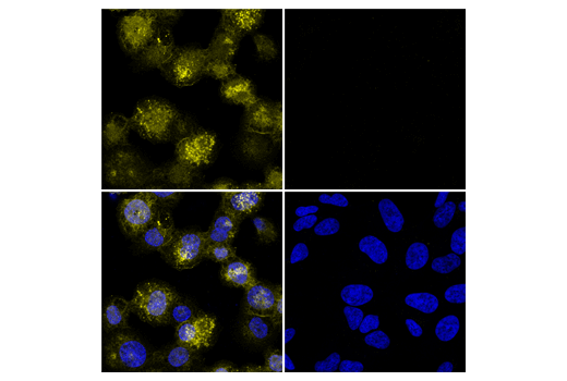 Iba1/AIF-1 (E4O4W) XP® Rabbit mAb (Alexa Fluor® 555 Iba1/AIF-1 (E4O4W) XP® Rabbit mAb (Alexa Fluor® 555