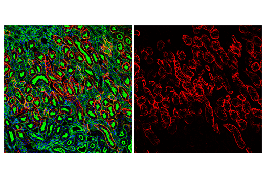 Immunofluorescence Image 3: AQP4 (D1F8E) Rabbit Monoclonal Antibody (Alexa Fluor<sup>®</sup> 647 Conjugate)