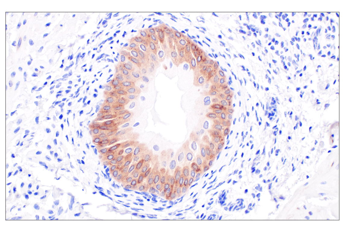Immunohistochemistry Image 7: IGFBP2 (F3E6V) Rabbit Monoclonal Antibody