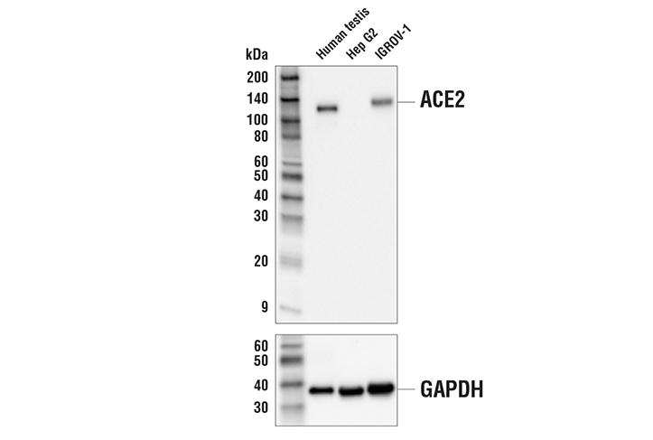 Western Blotting Image 1: ACE2 (OTI1G4) Mouse mAb