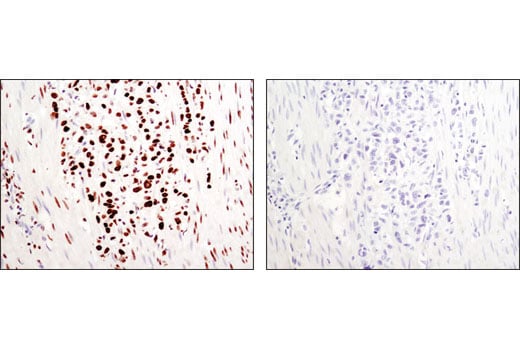 Immunohistochemistry Image 1: Di-Methyl-Histone H3 (Lys36) (C75H12) Rabbit Monoclonal Antibody (BSA and Azide Free)