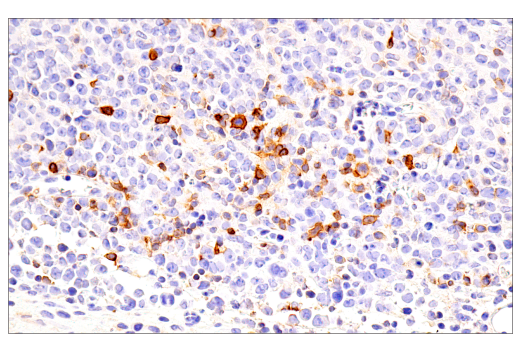 Immunohistochemistry Image 4: ICOS (E5F7E) Rabbit Monoclonal Antibody (BSA and Azide Free)
