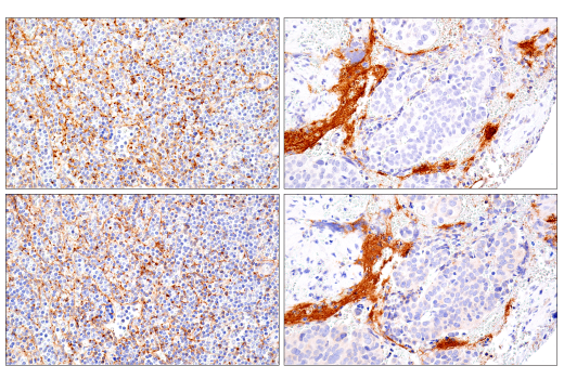 Immunohistochemistry Image 3: DNAM-1/CD226 (E8L9G) Rabbit Monoclonal Antibody (BSA and Azide Free)