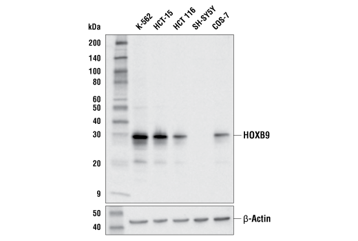 Western Blotting Image 1: HOXB9 (E7P5O) Rabbit mAb