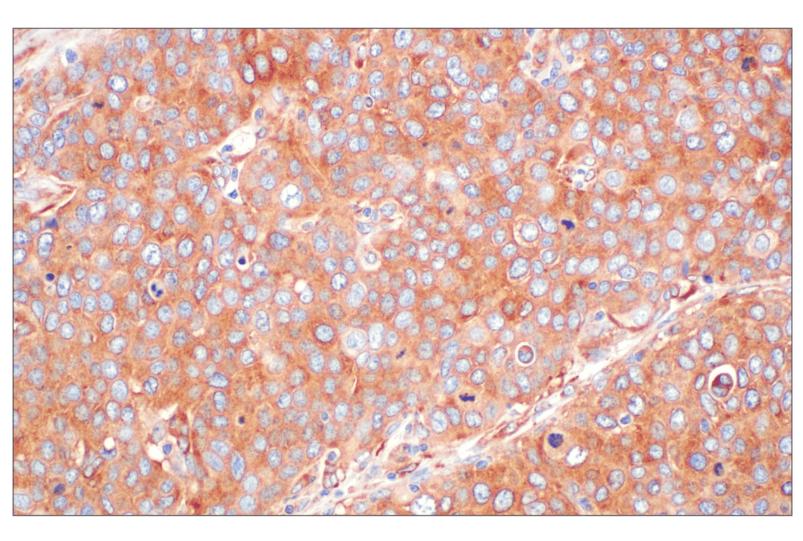 Immunohistochemistry Image 1: EEA1 (E9Q6G) Mouse Monoclonal Antibody