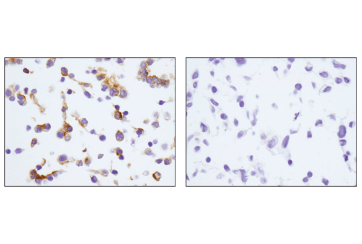 Immunohistochemistry Image 1: EpCAM (E6V8Y) Rabbit Monoclonal Antibody