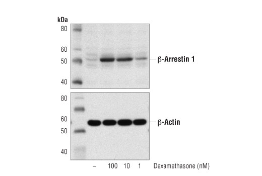 undefined Image 2: Dexamethasone