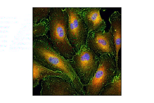 undefined Image 15: Actin Reorganization Antibody Sampler Kit
