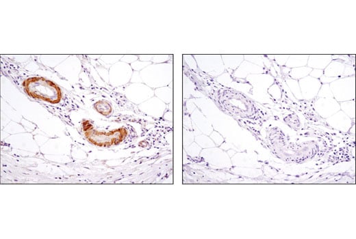 Immunohistochemistry Image 2: PKM1 (D30G6) Rabbit Monoclonal Antibody