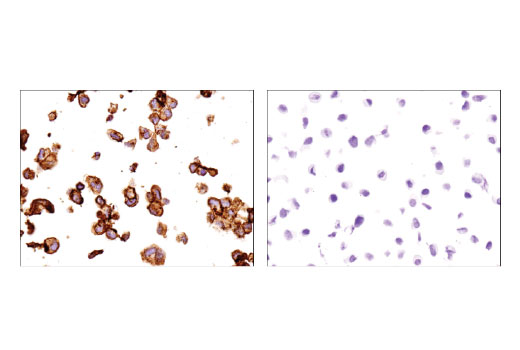 Immunohistochemistry Image 3: Cavin-1 (D1P6W) Rabbit Monoclonal Antibody