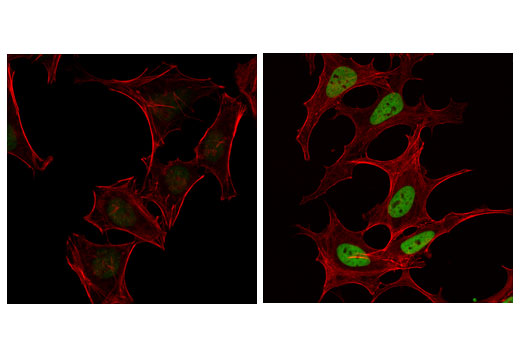 Immunofluorescence Image 1: Acetyl-Histone H4 (Lys16) (E2B8W) Rabbit Monoclonal Antibody