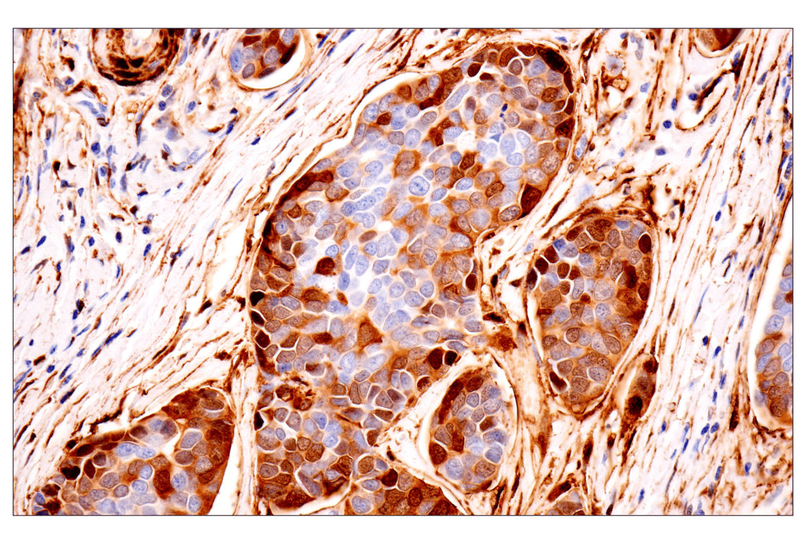 Immunohistochemistry Image 1: Transgelin/TAGLN (F3B7H) Rabbit Monoclonal Antibody