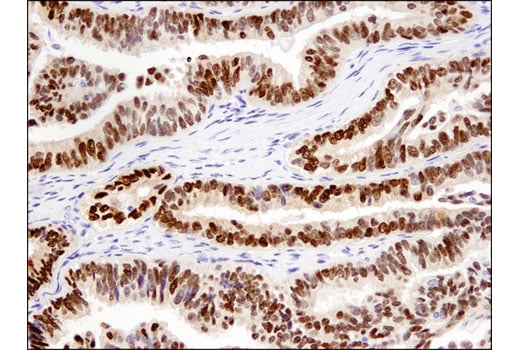 Immunohistochemistry Image 3: Sox9 (D8G8H) Rabbit Monoclonal Antibody
