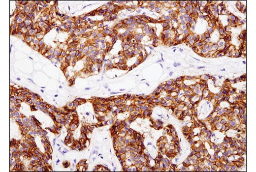 Immunohistochemistry Image 1: IGF-I Receptor beta (D4O6W) Rabbit Monoclonal Antibody