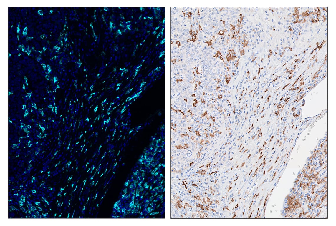 Immunohistochemistry Image 6: CD163 (D6U1J) & CO-0022-594 SignalStar<sup>™</sup> Oligo-Antibody Pair