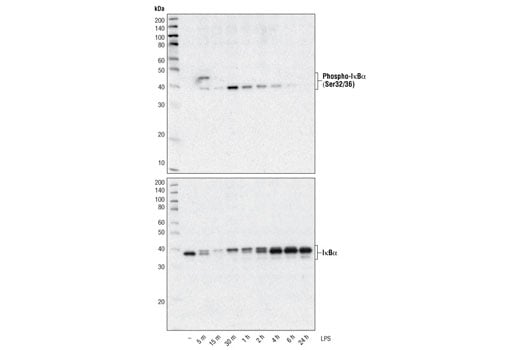 undefined Image 11: NF-kappaB Pathway Antibody Sampler Kit