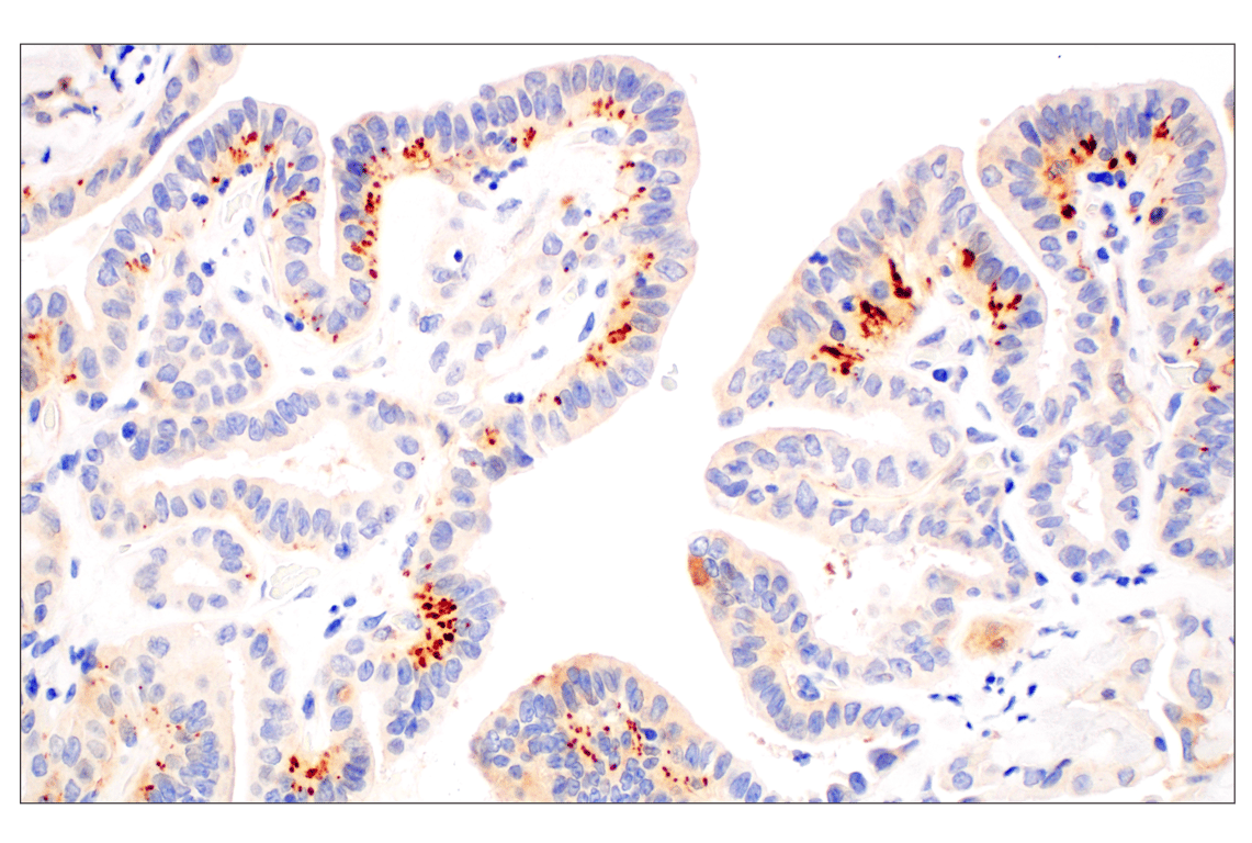 Immunohistochemistry Image 2: IL-13RA2/CD213a2 (E7U7B) Rabbit Monoclonal Antibody