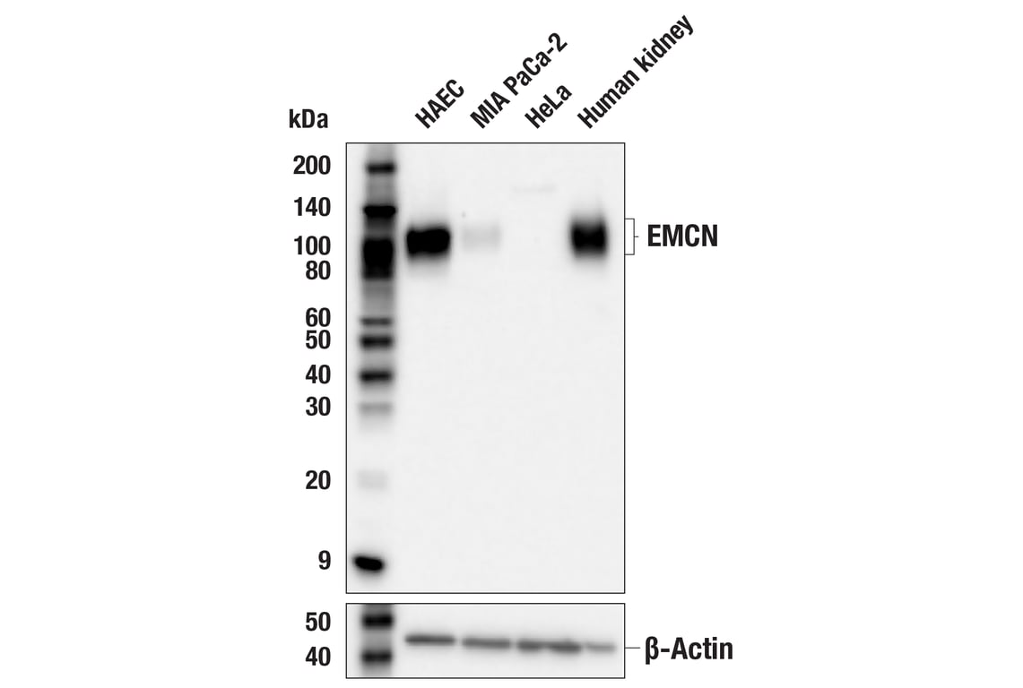 Western Blotting Image 1: EMCN (E3Z4D) Rabbit mAb