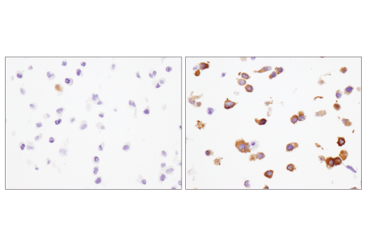 Immunohistochemistry Image 5: IFIT1 (D2X9Z) Rabbit Monoclonal Antibody (BSA and Azide Free)