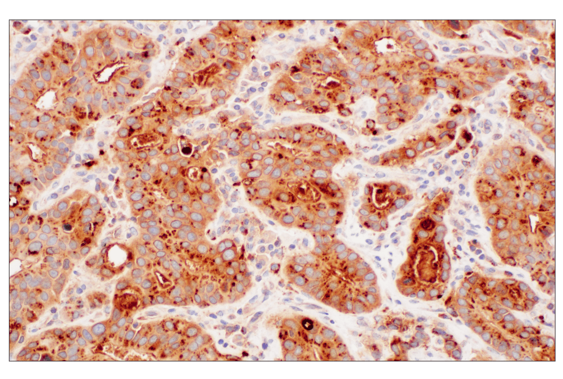 Immunohistochemistry Image 10: LY6E (F8Y1R) Rabbit Monoclonal Antibody