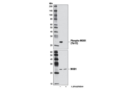 Western Blotting Image 2: Phospho-MOB1 (Thr12) (D2E3) Rabbit Monoclonal Antibody