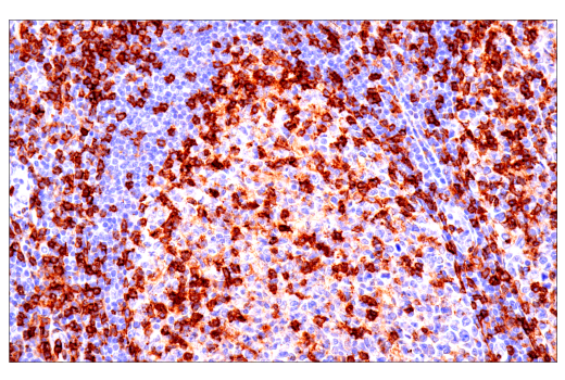 Immunohistochemistry Image 7: CD4 (EP204) Rabbit Monoclonal Antibody