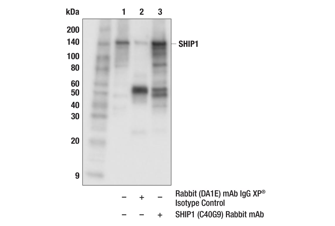 Immunoprecipitation Image 1: SHIP1 (C40G9) Rabbit Monoclonal Antibody